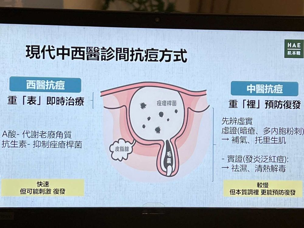 中西醫大不同！中醫師解答痘痘調理4重點：過敏性痘痘、成人痘、青春痘...，加碼無酸煥膚保養技巧-1