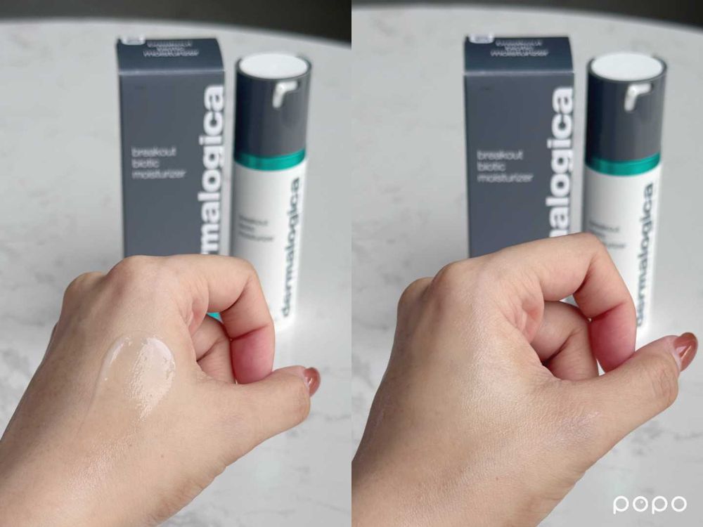 敏感肌更容易長痘痘？網友好評痘痘保養推薦，德卡、契爾氏、敏感話題...，這樣用快速消痘超有感！-11