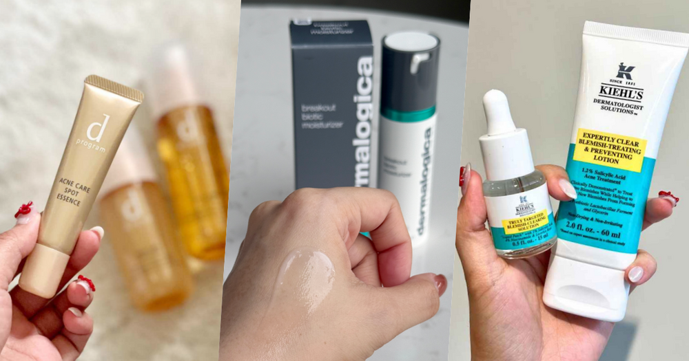 敏感肌更容易長痘痘？網友好評痘痘保養推薦，德卡、契爾氏、敏感話題...，這樣用快速消痘超有感！-1