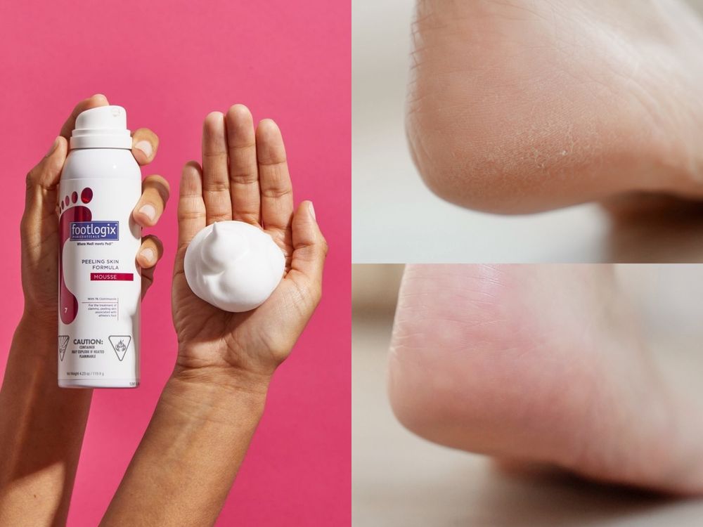 夏日美體技巧公開！抗暑保養重點：美胸、翹臀、去腳皮！-10