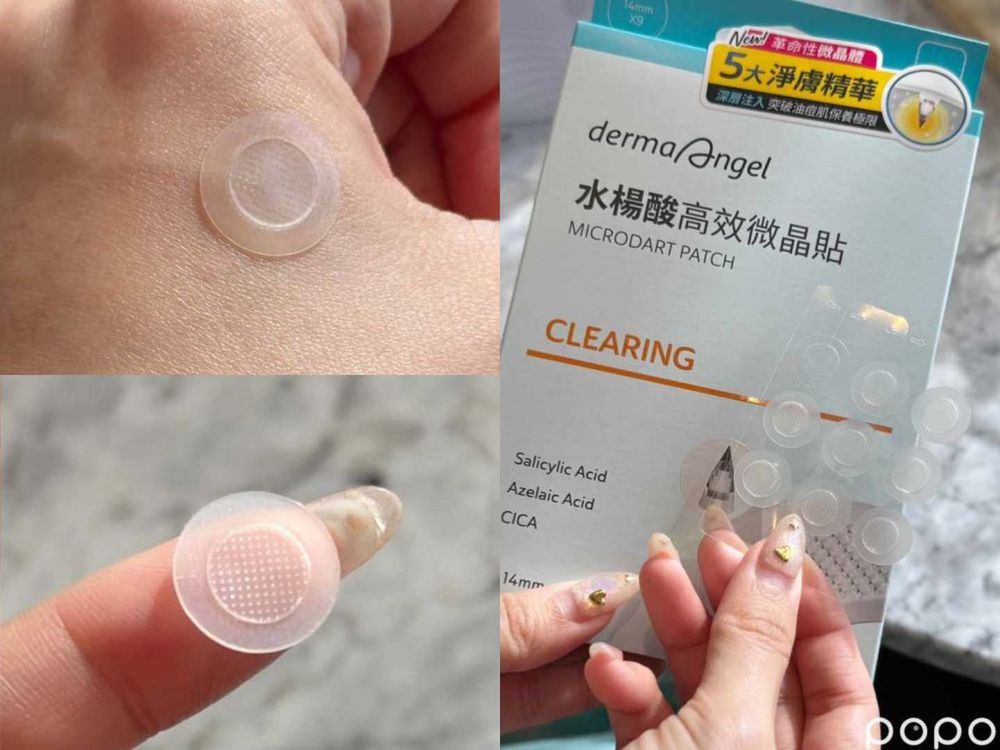 2025夏季痘痘保養推薦！Giselle愛用溫和煥膚精華、水楊酸微晶痘痘貼...，痘疤用「它」淡化最快速！-2