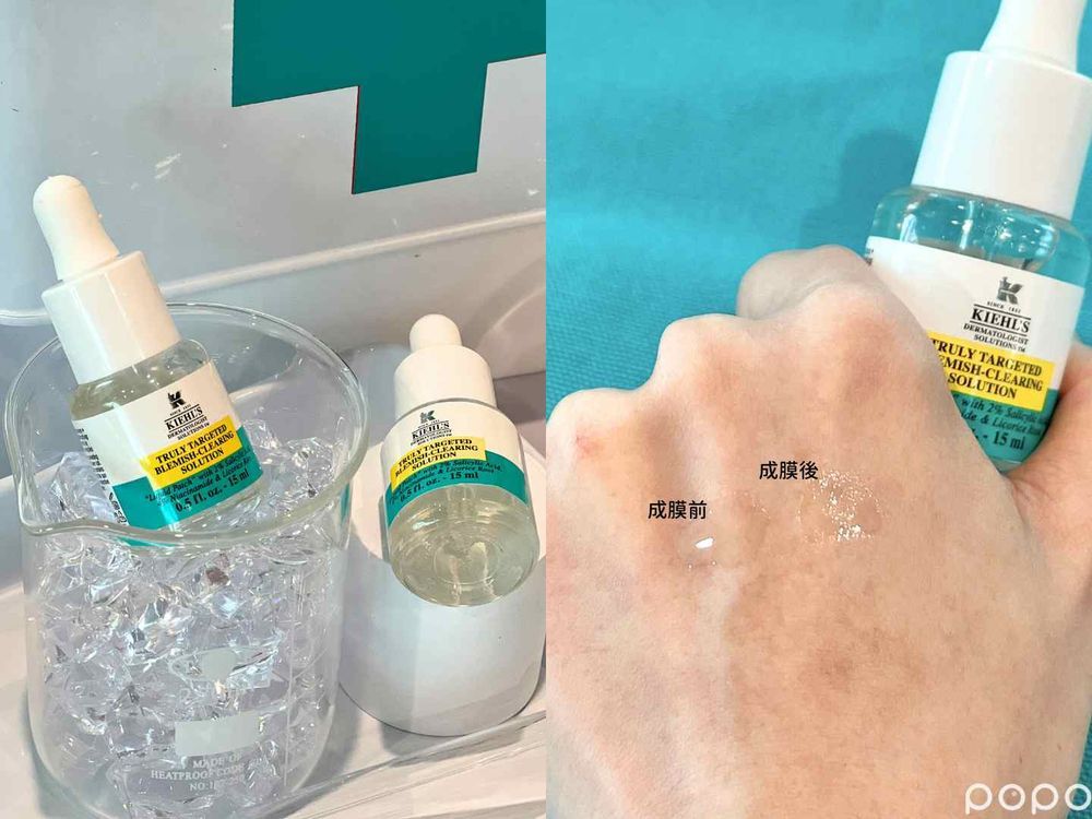 痘痘貼正確用法公開！哪種痘痘適合貼？妝前「這樣貼」超隱形...，美妝版大推人氣痘痘貼推薦！-18
