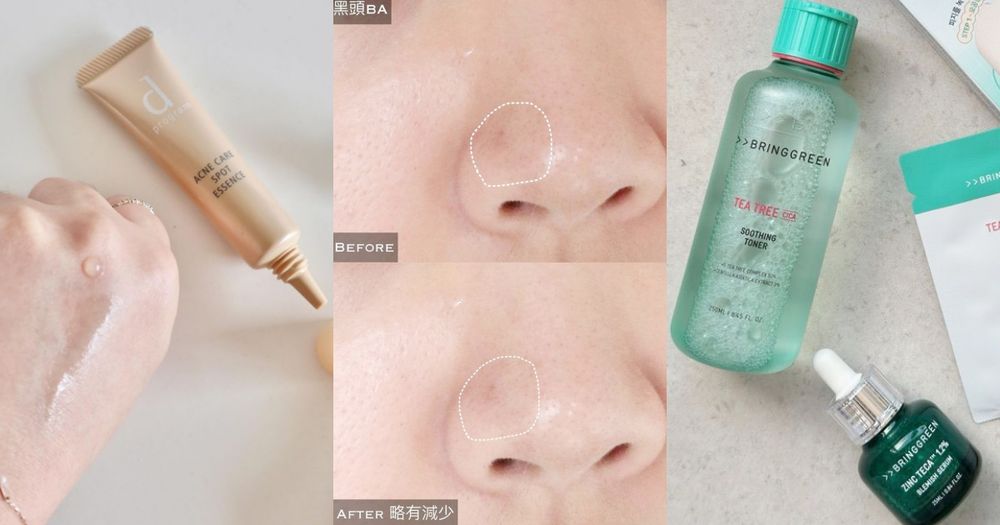 脆友大推痘痘保養！護妍天使、敏感話題抗痘超有感，日女愛用去痘洗面乳，這瓶效果媲美「水飛梭」！-1