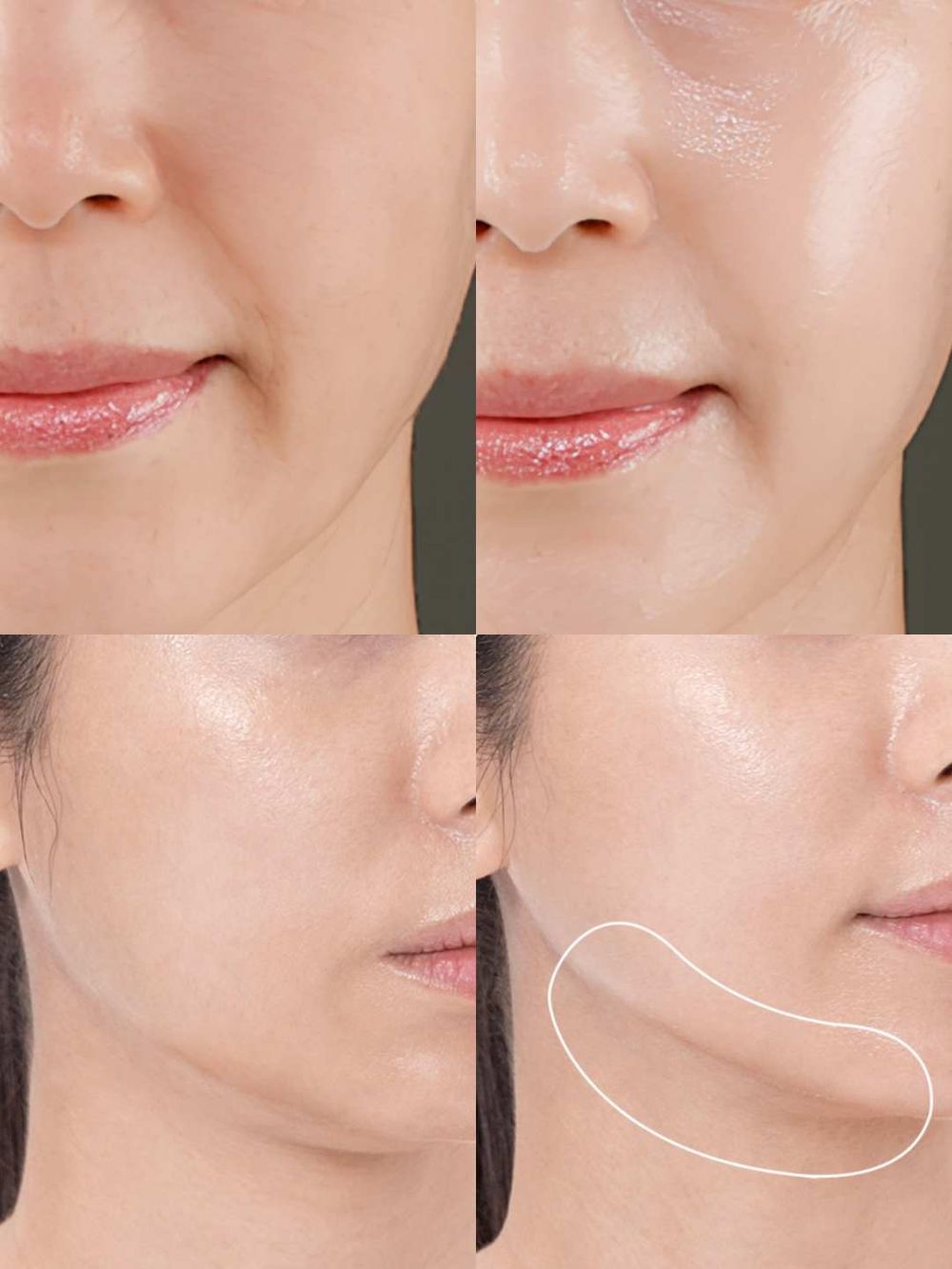 與張員瑛的美肌距離只差一台美容儀！Medicube x 蠟筆小新夢幻連動「小新小白收納頭套、公仔」可愛到想整套收藏！-11