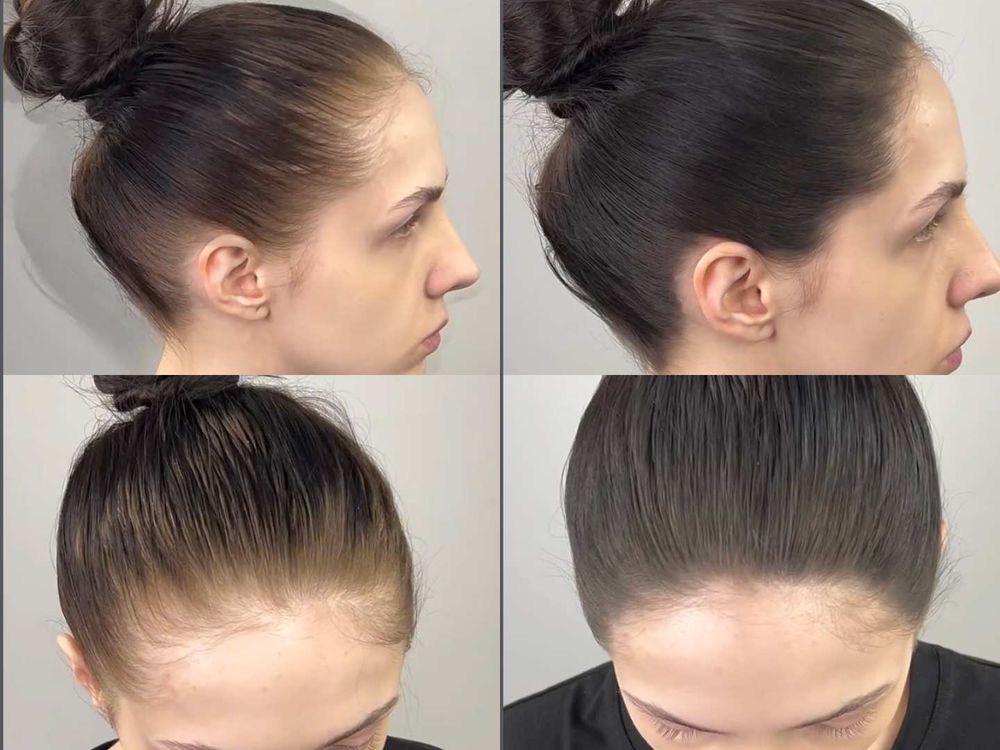 aespa Winter留言引爆全網關注！布丁頭剋星「髮根補染粉」淺髮色暫時性補染、調整髮際線修小臉，一小瓶全搞定！-8