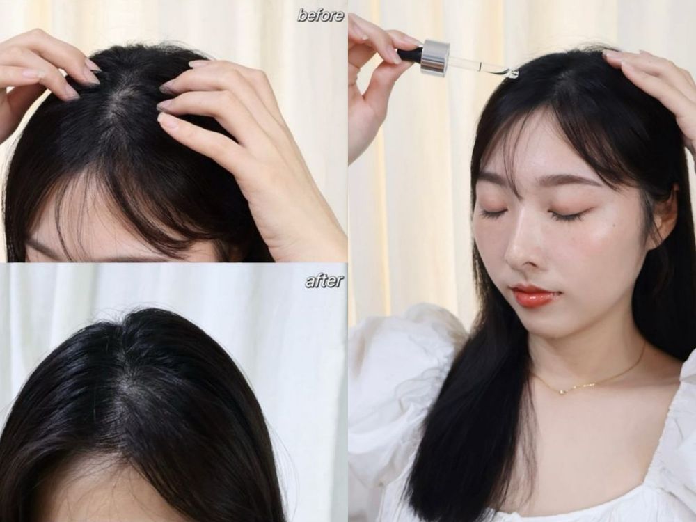 頭皮味退散！網友好評頭皮精華推薦，韓國OLIVE YOUNG人氣安瓶、台灣女生最愛涼感養髮精華液，用完髮根蓬鬆輕盈！-3
