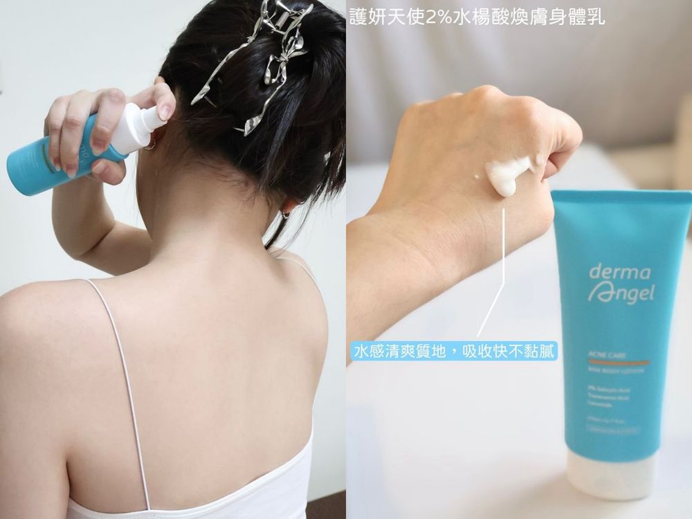 夏日美背養成計劃！網友激推煥膚身體乳/沐浴露，背痘、胸痘通通消滅，輕鬆養出細嫩拋光美肌！！-8
