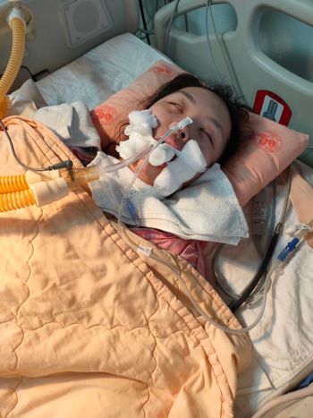 1026急性腦膜炎發作