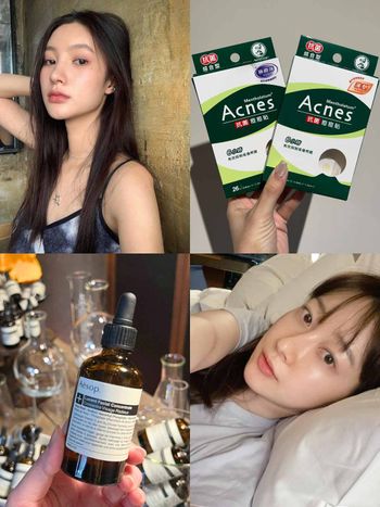 2023抗痘保養推薦！5個抗痘好習慣，養成零瑕疵水煮蛋肌，保證毛孔粗大、粉刺再也不打擾你