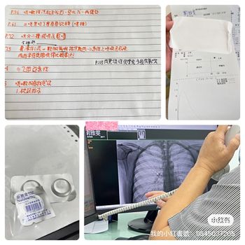 ［2023/10/15］還沒好的 #乾咳[话题]#