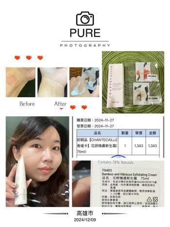 [2024/12/9]香緹卡舒緩我的過敏肌