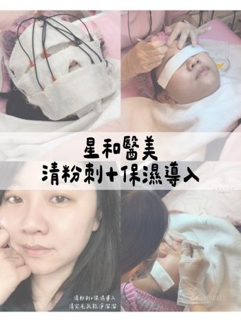 ♡星醫美學院♡敷面式離子導入