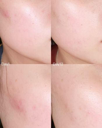 MEDITHERAPY維他命冰肌系列美白組合