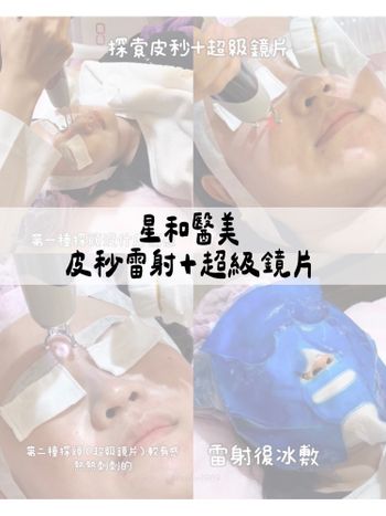 ♡星采星和醫美♡皮秒雷射+超級鏡片💞