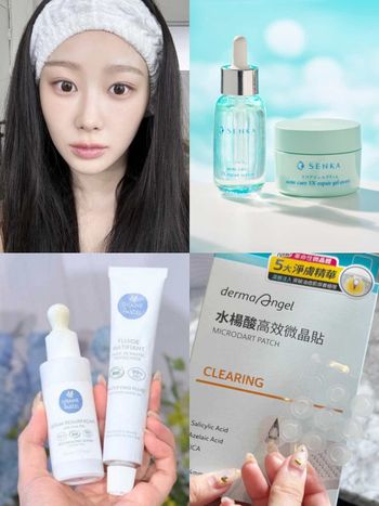 2025夏季痘痘保養推薦！Giselle愛用溫和煥膚精華、水楊酸微晶痘痘貼...，痘疤用「它」淡化最快速！