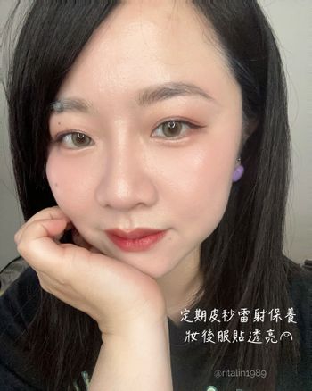 ♡星和醫美♡皮秒雷射💕💕