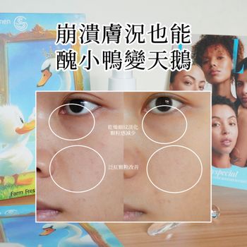 崩潰膚況也能醜小鴨變天鵝