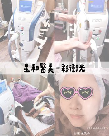 ♡星采星和醫美♡彩衝光雷射✨