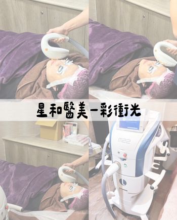 ♡星和醫美♡彩衝光～～月保養日記