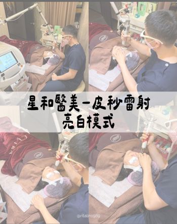 星和醫美-皮秒雷射（亮白模式）💕