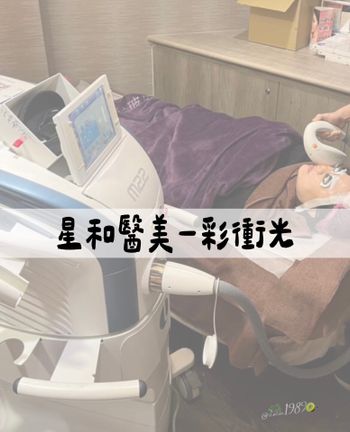 星和醫美-彩衝光 紀錄📝