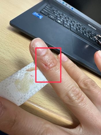 無印良品不鏽鋼削皮器到底是不是神器？我先被它削到手了…#我來開箱