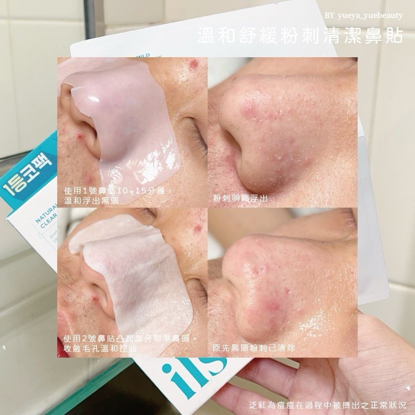 Threads爆紅美妝五選！ilso粉刺鼻貼、寶拉珍選水楊酸身體乳...，OLIVE YOUNG賣最好氣墊、用過回不去！-10