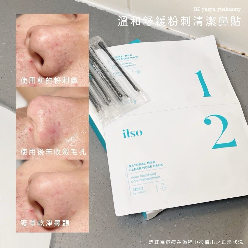 Threads爆紅美妝五選！ilso粉刺鼻貼、寶拉珍選水楊酸身體乳...，OLIVE YOUNG賣最好氣墊、用過回不去！-9