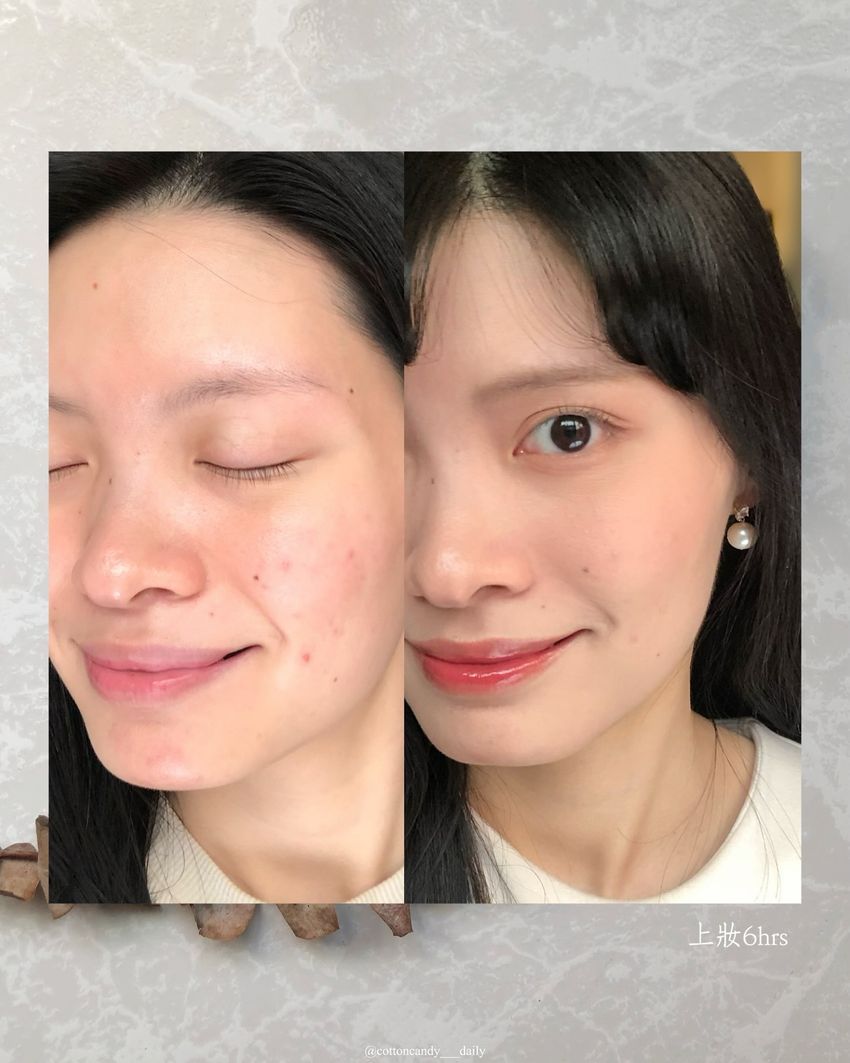 Threads爆紅美妝五選！ilso粉刺鼻貼、寶拉珍選水楊酸身體乳...，OLIVE YOUNG賣最好氣墊、用過回不去！-6