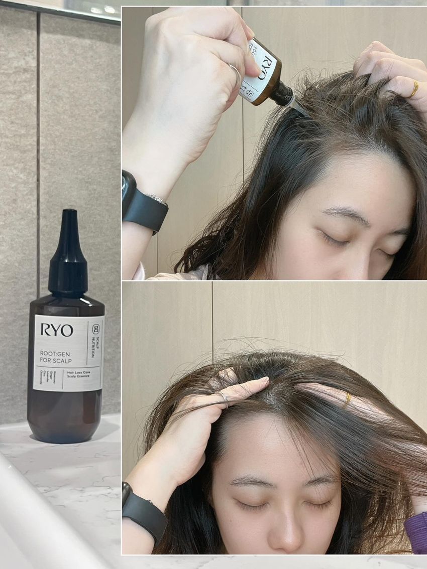 頭皮味退散！網友好評頭皮精華推薦，韓國OLIVE YOUNG人氣安瓶、台灣女生最愛涼感養髮精華液，用完髮根蓬鬆輕盈！-11